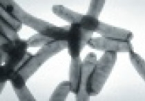 Zanim zabije Cię Twoje jaccuzi