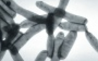 Zanim zabije Cię Twoje jaccuzi