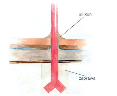 Schemat: Właściwe ukształtowanie silikonowego uszczelnienia wokół słupka balustrady